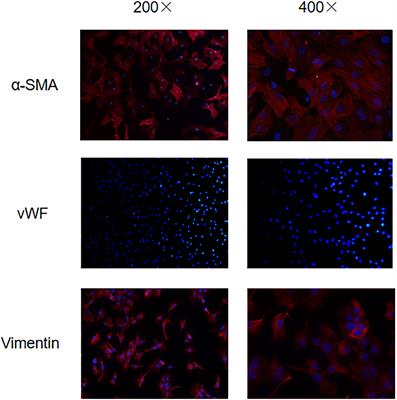 Mechanism of Endoplasmic Reticulum Stress Pathway in the Osteogenic Phenotypic Transformation of Aortic Valve Interstitial Cells